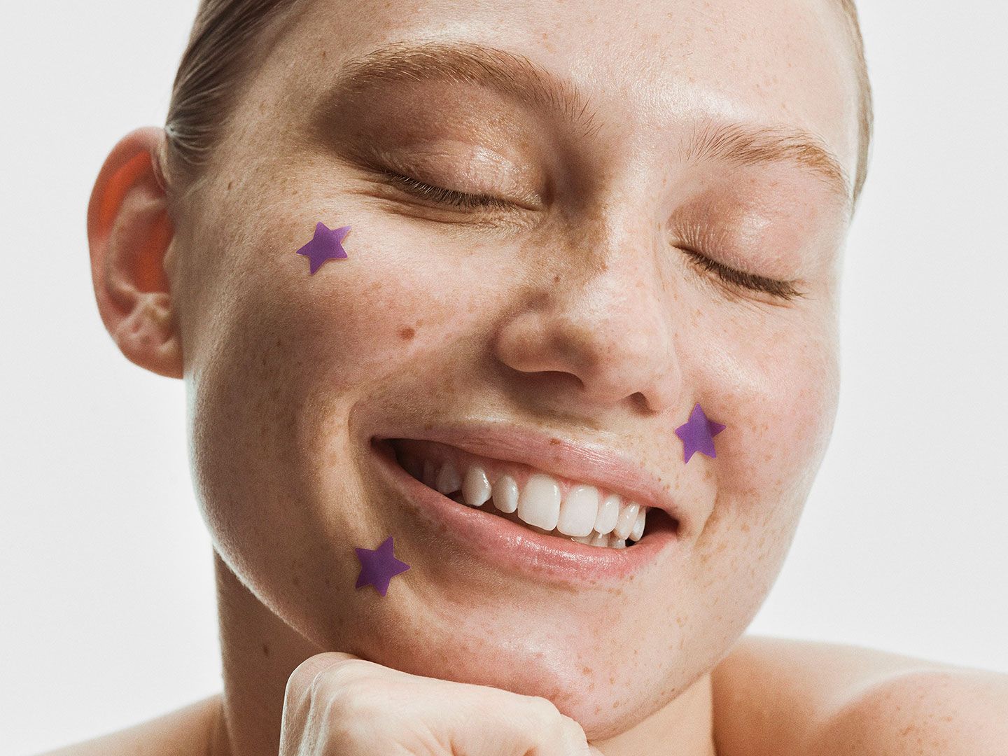 11 pimple patches that genuinely work