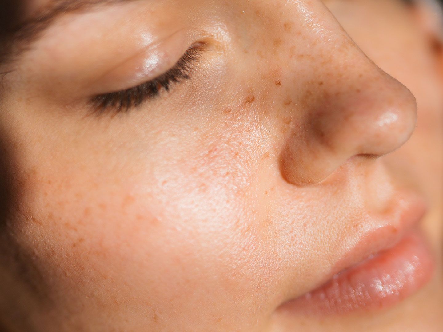 How to get rid of pores? The experts weigh in on shrinking yours
